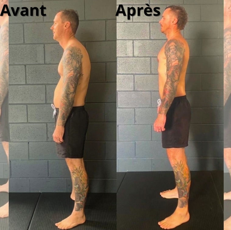ErgoFit™ – Le Correcteur de Posture Intelligent