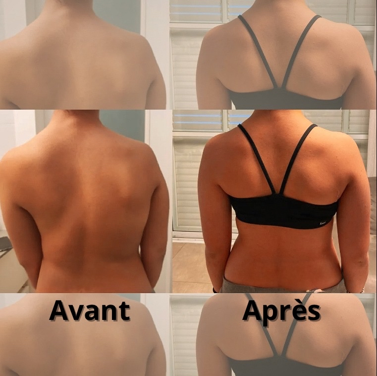 ErgoFit™ – Le Correcteur de Posture Intelligent